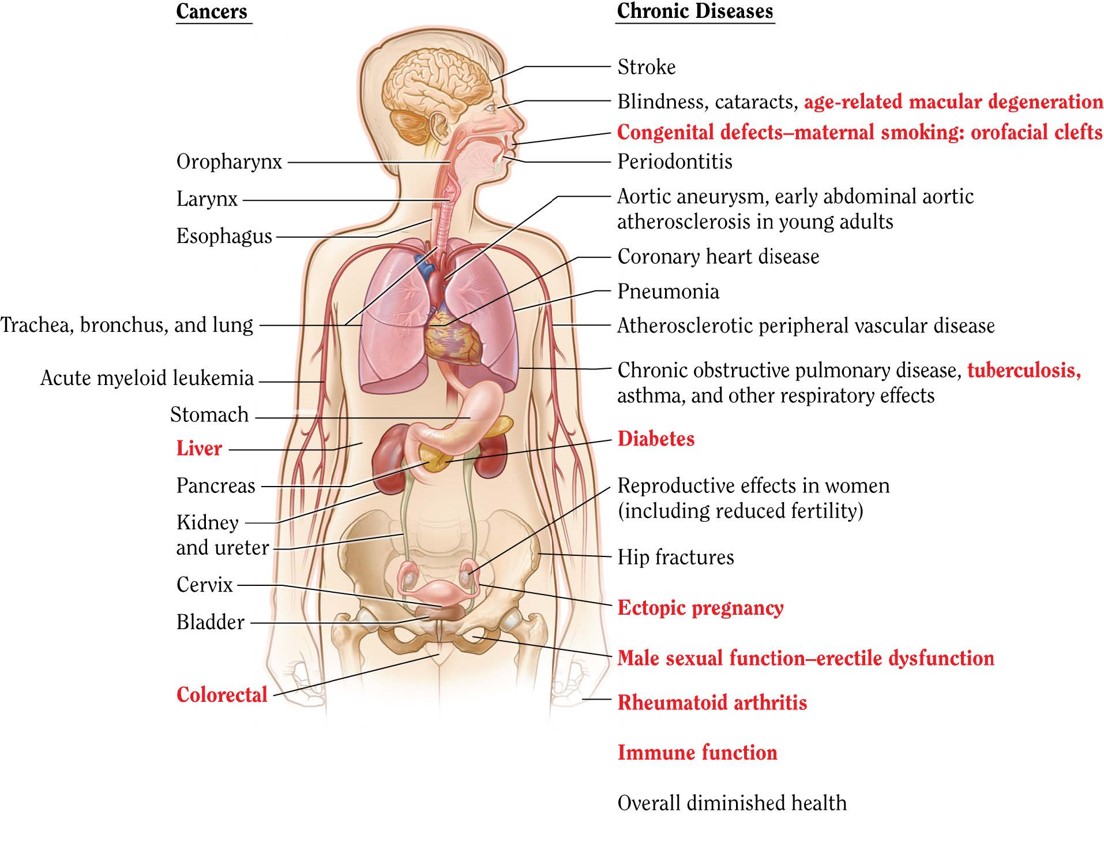 diseases associated with tobacco use Active Smoking
